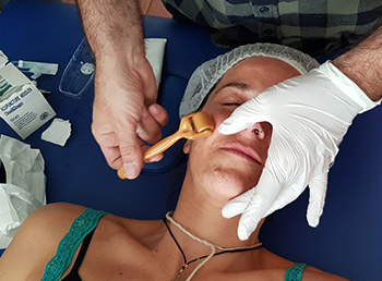 Curso acupuntura facial y corporal