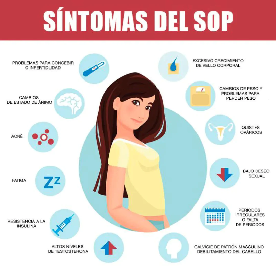 Sintomas del Sindrome del ovario poliquistico