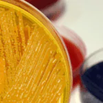 La carne y el problema de la Escherichia coli