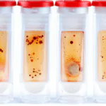 Inteligencia Microbiana