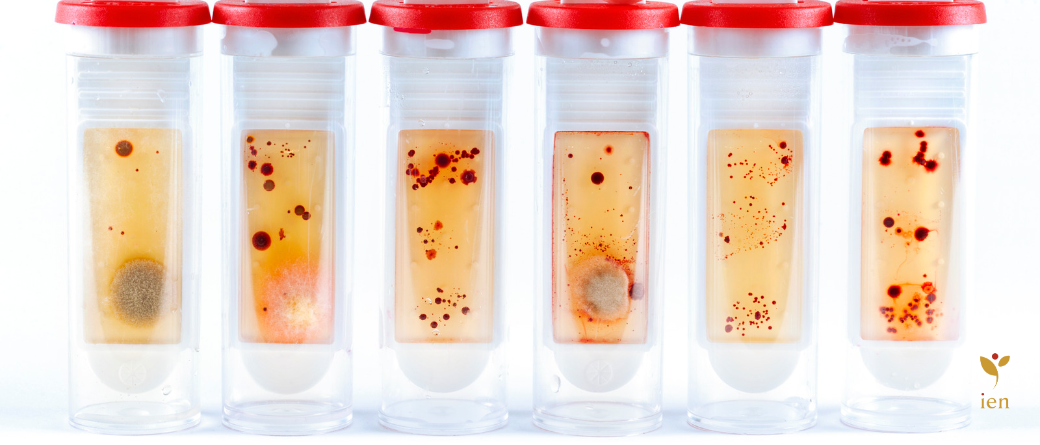 Inteligencia Microbiana