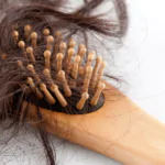 caida cabello